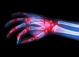 Inflammation research Inflammation Research Kinases