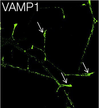 COL22112-711822-VAMP1-IF-large COL22112-711822-VAMP1-IF-large