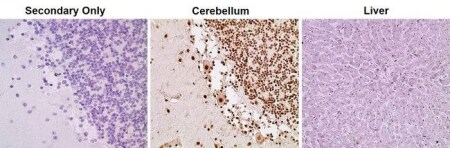 Immunohistochemistry analysis of HP1 alpha reader that binds to H3K9 Immunohistochemistry analysis of HP1 alpha reader that binds to H3K9