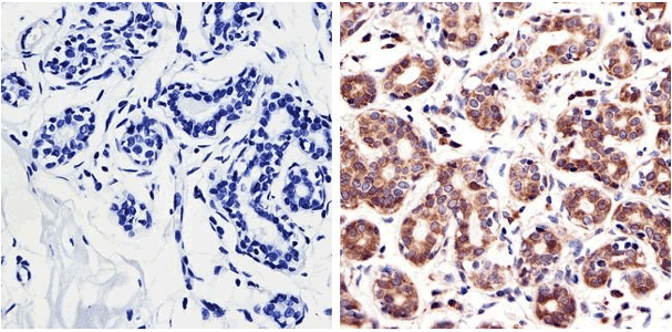 Immunohistochemistry analysis of RAC1 using PA1-091 Immunohistochemistry analysis of RAC1 using PA1-091