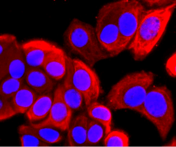 Immunocytochemistry analysis of ARF6 using MA5-32558 Immunocytochemistry analysis of ARF6 using MA5-32558