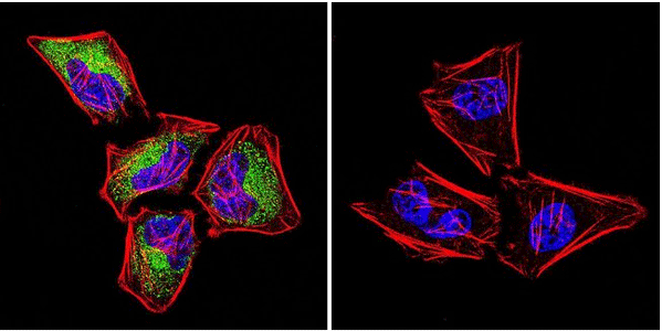Immunofluorescent analysis of Ras using MA1-012 Immunofluorescent analysis of Ras using MA1-012