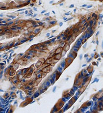 Immunohistochemical analysis of Galectin-9 Immunohistochemical analysis of Galectin-9