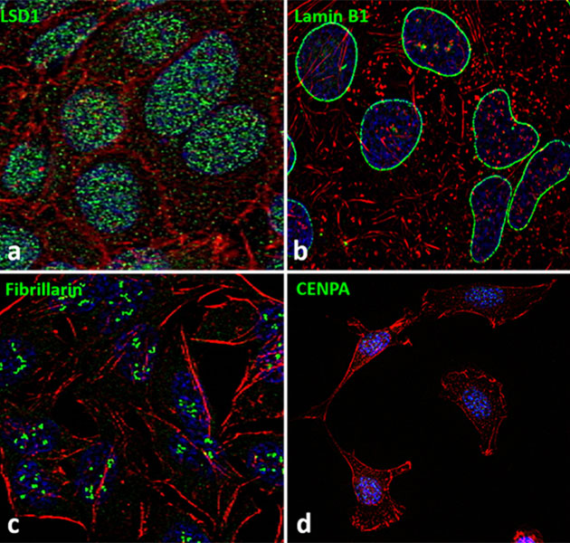 Immunofluorescence analysis of LSD1, Lamin B1, Fibrillarin, and CENPA in HeLa and HIH/3T3 cells Immunofluorescence analysis of LSD1, Lamin B1, Fibrillarin, and CENPA in HeLa and HIH/3T3 cells
