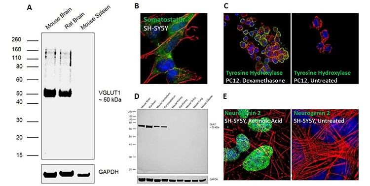 Western blot, immunofluorescent, and immunocytochemistry analysis of mature neuron markers in various cell lines Western blot, immunofluorescent, and immunocytochemistry analysis of mature neuron markers in various cell lines