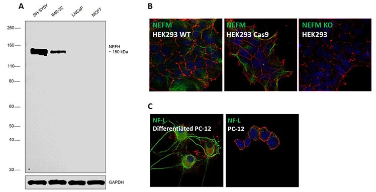 Western blot and ICC analysis of NEFH, HEFM, and HEFL in various cell lines Western blot and ICC analysis of NEFH, HEFM, and HEFL in various cell lines