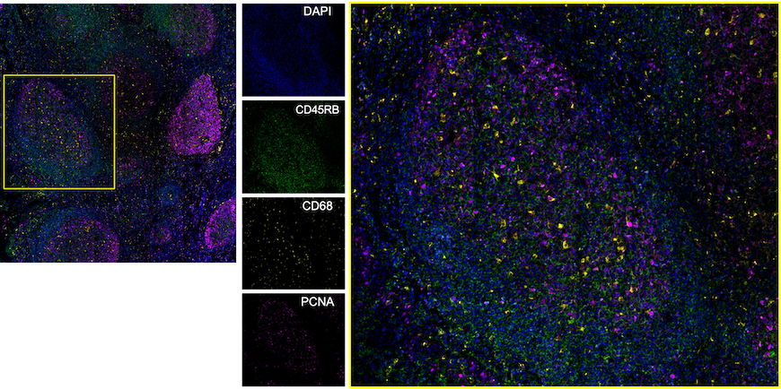 Multiplexed image of human tonsil tissue Multiplexed image of human tonsil tissue stained with primary antibodies conjugated using ReadyLabel Kits, showing individual conjugate stains.