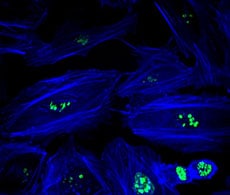 Zip快速抗体标记试剂盒 Zip快速抗体标记试剂盒