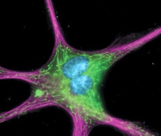 permeabilized-bovine-pulmonary-artery-endothelial-cell permeabilized-bovine-pulmonary-artery-endothelial-cell