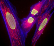 microscopy-analysis-muntjac-fibroblasts microscopy-analysis-muntjac-fibroblasts