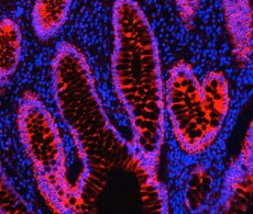000006-IHC-cytokeratin-DyLight-594-streptavidin-230 000006-IHC-cytokeratin-DyLight-594-streptavidin-230