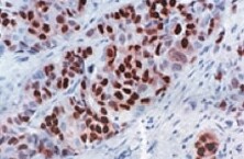 enzyme-labeled-streptavidin-avidin-conjugates enzyme-labeled-streptavidin-avidin-conjugates