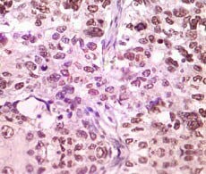 monoclonal-antibod-pure-230x195 monoclonal-antibod-pure-230x195