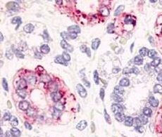 custom-polyclonal-antibody-purification custom-polyclonal-antibody-purification