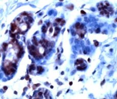 32570_Antibody_Immunohistochemistry-230 32570_Antibody_Immunohistochemistry-230