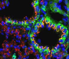 Invitrogen 定制抗体开发 Invitrogen 定制抗体开发