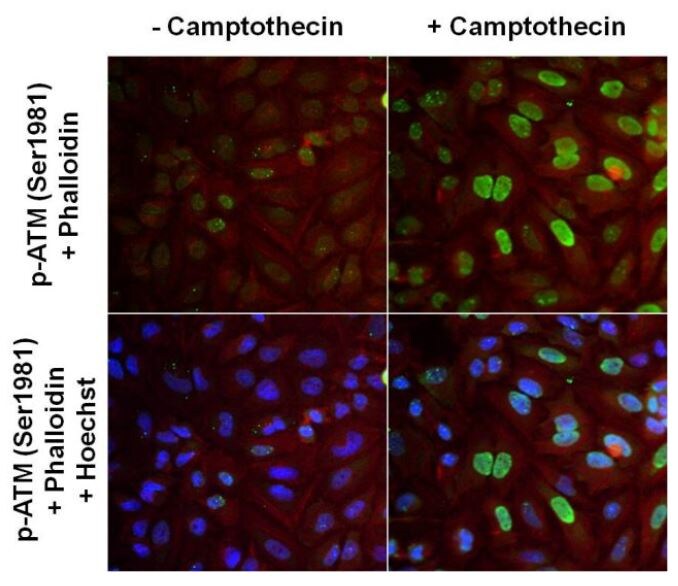 Immunofluorescence analysis of ATM phosphorylated Immunofluorescence analysis of ATM phosphorylated