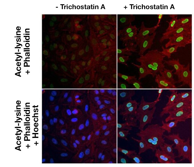 Immunofluorescence analysis of lysine acetylated proteins Immunofluorescence analysis of lysine acetylated proteins