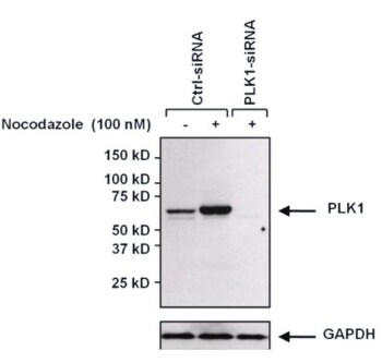 PLK1 免疫印迹分析 PLK1 免疫印迹分析