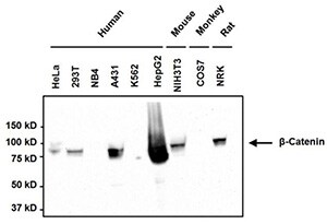 Western blot analysis of beta-Catenin. Western blot analysis of beta-Catenin.