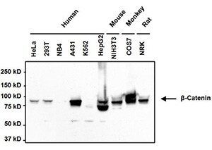 Western blot analysis of beta-Catenin Western blot analysis of beta-Catenin