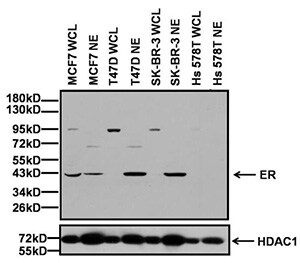Western blot analysis of Estrogen Receptor Western blot analysis of Estrogen Receptor