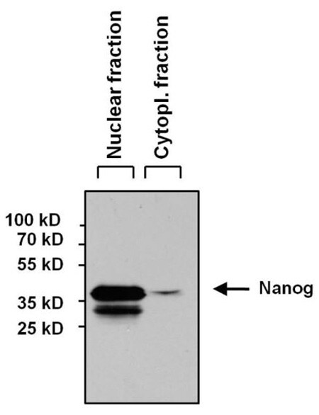 Western blot Western blot