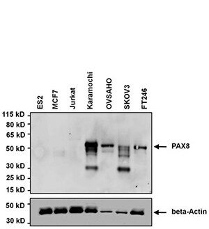 Western blot analysis of PAX8 Western blot analysis of PAX8
