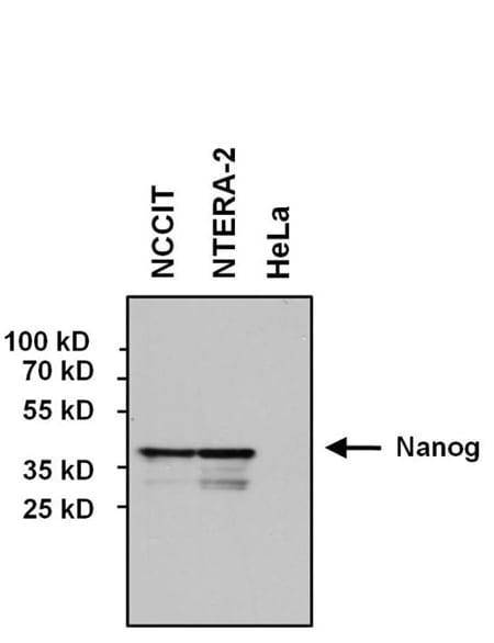 Western blot Western blot