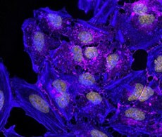 Antibodies for Applications: Immunofluorescence using beta Catenin antibody. Antibodies for Applications: Immunofluorescence using beta Catenin antibody.
