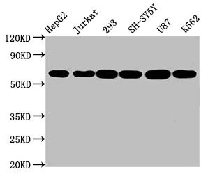 Western blot analysis of aromatase Western blot analysis of aromatase