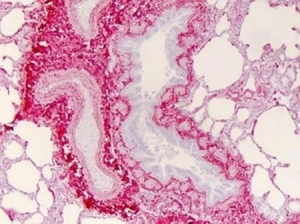 Immunohistochemical analysis of collagen I Immunohistochemical analysis of collagen I