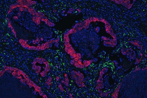 Immunofluorescence analysis of collagen IV Immunofluorescence analysis of collagen IV