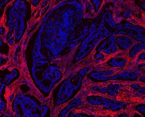 Immunofluorescence analysis of collagen I Immunofluorescence analysis of collagen I