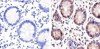 Immunohistochemistry analysis of ZO-3 Immunohistochemistry analysis of ZO-3