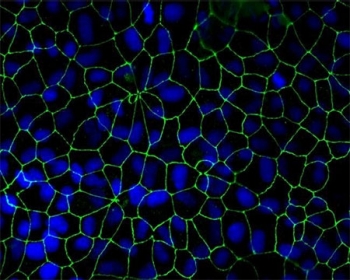 Immunofluorescent analysis of ZO-1 Immunofluorescent analysis of ZO-1