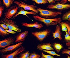 内参抗体 内参抗体