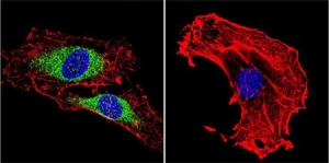 Immunofluorescent analysis of Vimentin Immunofluorescent analysis of Vimentin