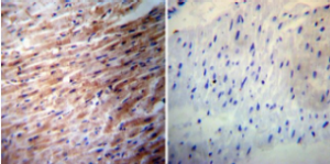 Immunohistochemistry performed on normal deparaffinized human heart tissue. Immunohistochemistry performed on normal deparaffinized human heart tissue.