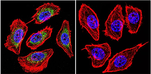 Immunofluorescent analysis of HIF-1 alpha using an antibody recognizing HIF-1 alpha shows staining in U251 cells. Immunofluorescent analysis of HIF-1 alpha using an antibody recognizing HIF-1 alpha shows staining in U251 cells.