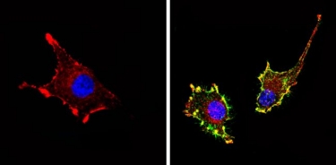 Immunofluorescent analysis of CD81 (green) showing staining in the membrane of U-87 MG cells Immunofluorescent analysis of CD81 (green) showing staining in the membrane of U-87 MG cells