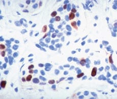 癌症研究抗体 癌症研究抗体