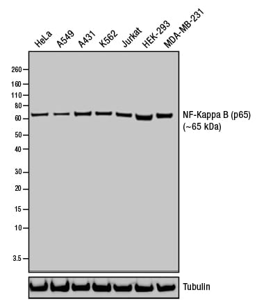 NF-κB(p65)的蛋白质免疫印迹分析。 NF-κB(p65)的蛋白质免疫印迹分析。