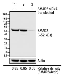 用siRNA转染HeLa细胞后检测到的SMAD2表达。 用siRNA转染HeLa细胞后检测到的SMAD2表达。