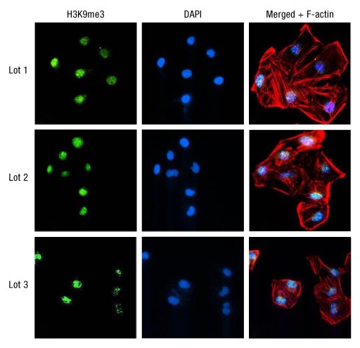 未在3个批次的H3K9me3抗体中检测到差异。 未在3个批次的H3K9me3抗体中检测到差异。