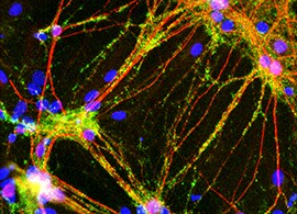 免疫荧光分析神经元 免疫荧光分析神经元