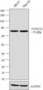 FOXO3 的蛋白质印迹分析 FOXO3 的蛋白质印迹分析