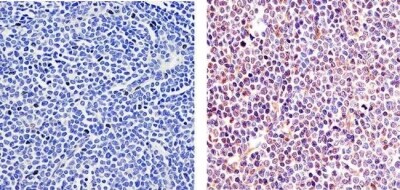 Immunohistochemistry analysis of ETS Immunohistochemistry analysis of ETS