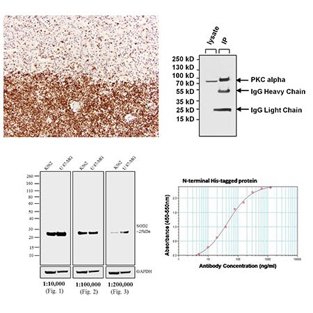 用于IHC、蛋白质印迹、IP和ELISA的HRP辣根过氧化物酶标记二抗应用数据 用于IHC、蛋白质印迹、IP和ELISA的HRP辣根过氧化物酶标记二抗应用数据