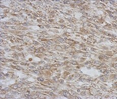 31790_Antibody_Immunohistochemistry_2 31790_Antibody_Immunohistochemistry_2